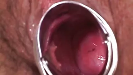 డాగ్హౌస్